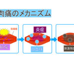 筋肉痛は悪か正義か！？　