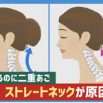 【肩こり・首こり】の原因、ストレートネックを改善！