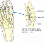 足の痺れが気になったら、疑うこと！