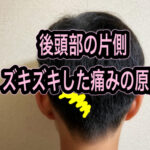 後頭神経痛になってしまった！マジで痛い。