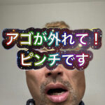 顎が外れた！！痛すぎる・・・